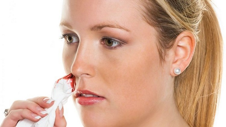 Кровотечение из носа 