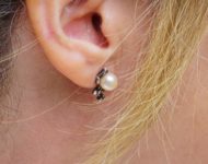 Миниатюра к статье Почему шумит в ушах - основные причины и способы лечения