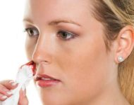 Миниатюра к статье Почему течёт кровь из носа и как с этим бороться?