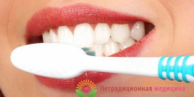 Миниатюра к статье Можно ли отбелить зубы содой в домашних условиях?
